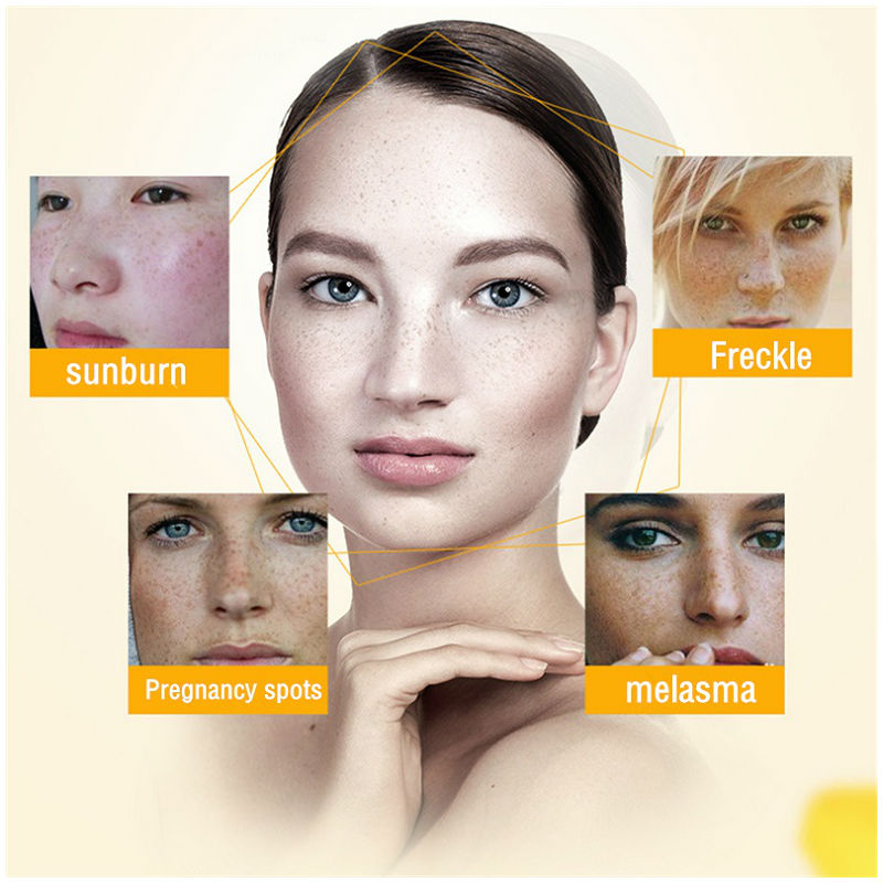 Dimollaure Whitening Freckle C - огляд і ціна Beauty Glazed Makeup