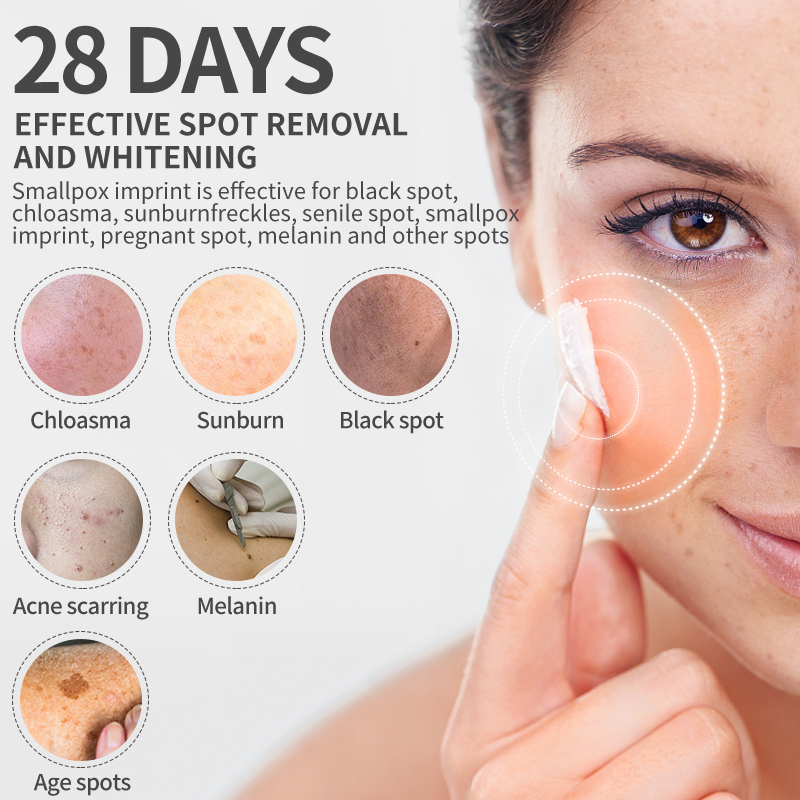 Dimollaure Whitening Freckle C - огляд і ціна Beauty Glazed Makeup